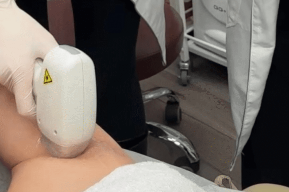 Why Choose Elite College for Your Laser Hair Removal Course in Canada?
