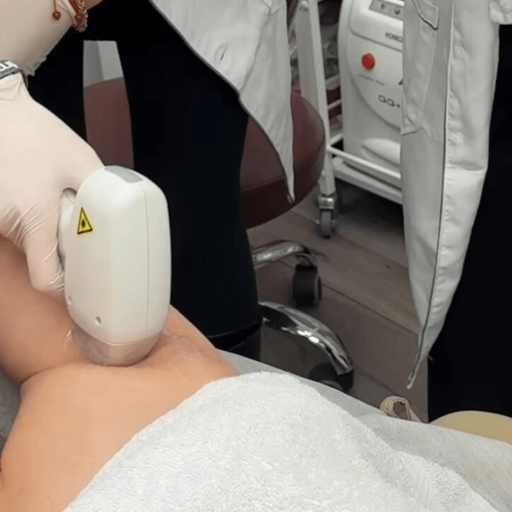 Why Choose Elite College for Your Laser Hair Removal Course in Canada?