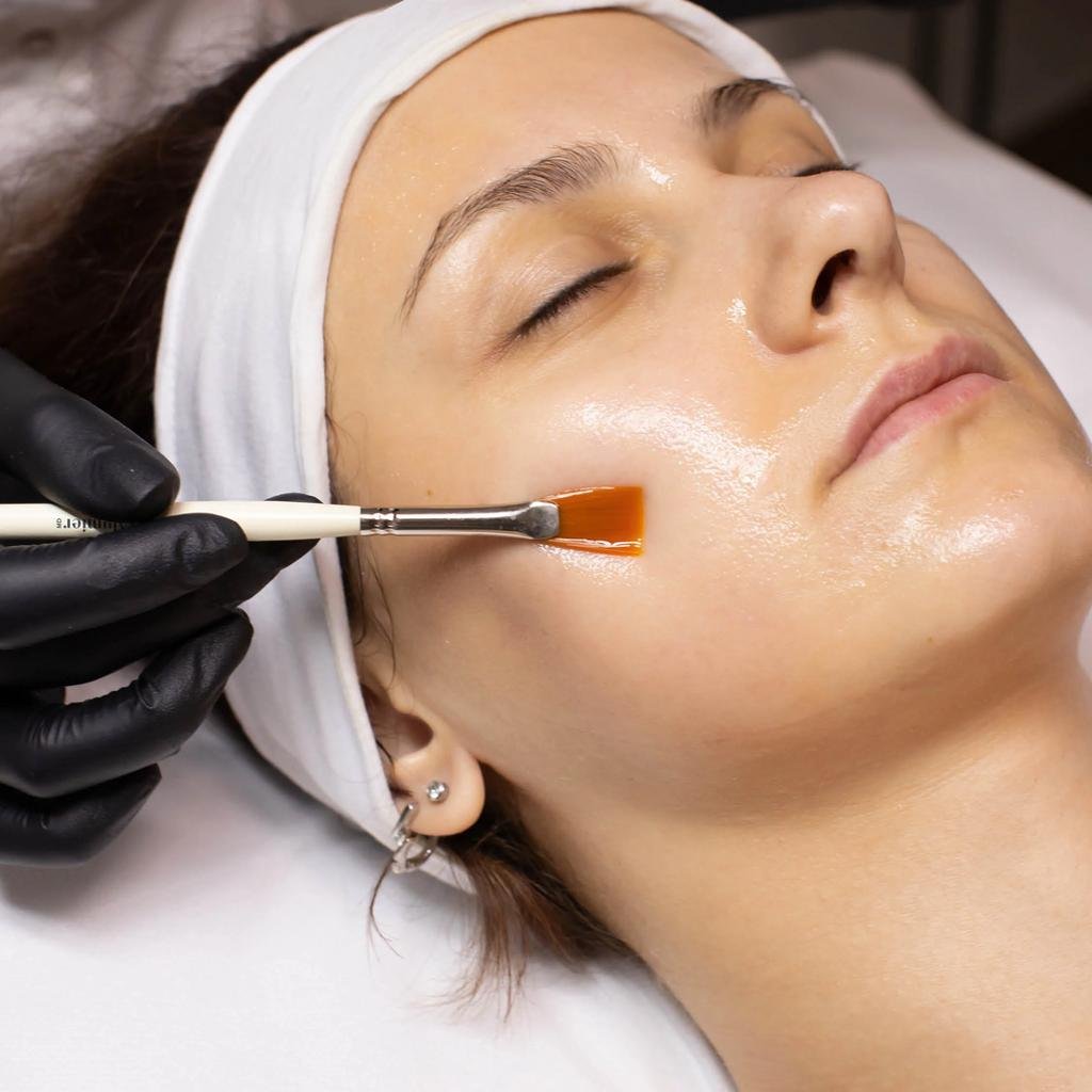 Chemical Peeling Certificate – Elite College Montréal